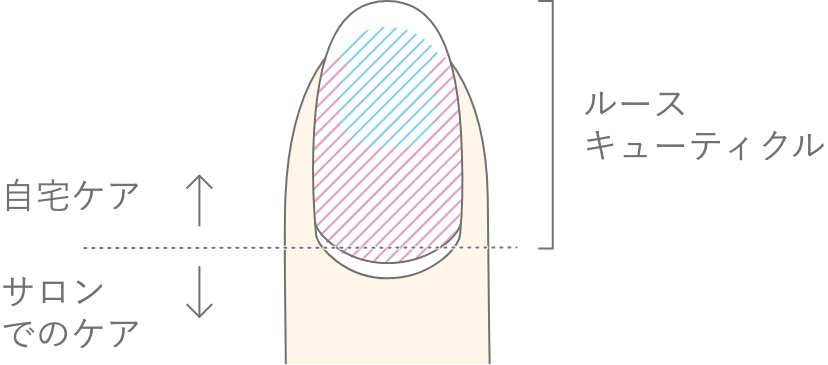 ルースキューティクルについてを説明する画像